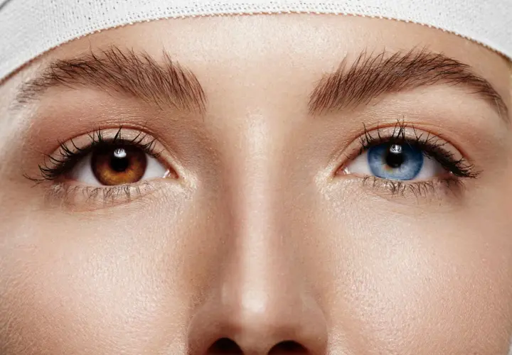 Oczy z **heterochromią centralną**: jedno brązowe, drugie niebieskie. Wokół nich delikatna skóra i podkreślone rzęsy.