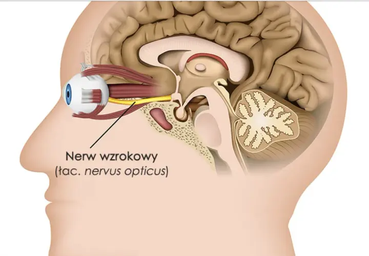 Przekrój głowy ukazujący oko i mózg. Żółty nerw wzrokowy łączy oko z mózgiem, umożliwiając widzenie.